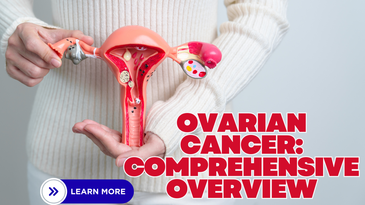 Ovarian Cancer: A General Overview