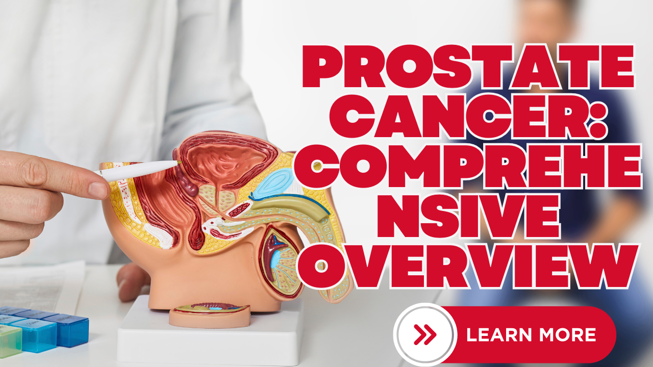 Prostate Cancer: Comprehensive Overview